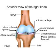 Anterior View of Right Knee Total Knee Replacement Surgeon bangalore