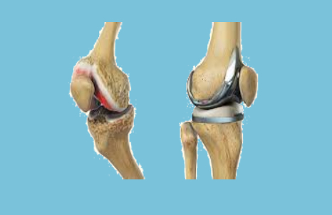 Orthopedic Specialist in bangalore